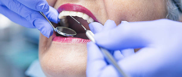 Best Emergency Wisdom Teeth Removal in Vassar, MI